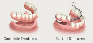 Minimally Invasive Cosmetic Filling (Light cure filling)